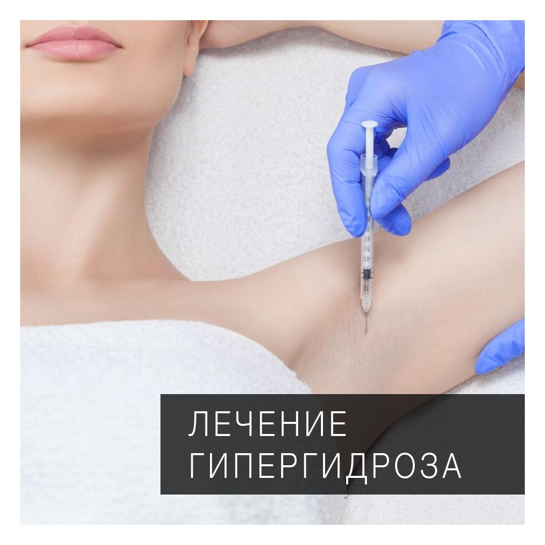 Гипергидроз, это повышенное потоотделение вызванное сторонними заболеваниями.