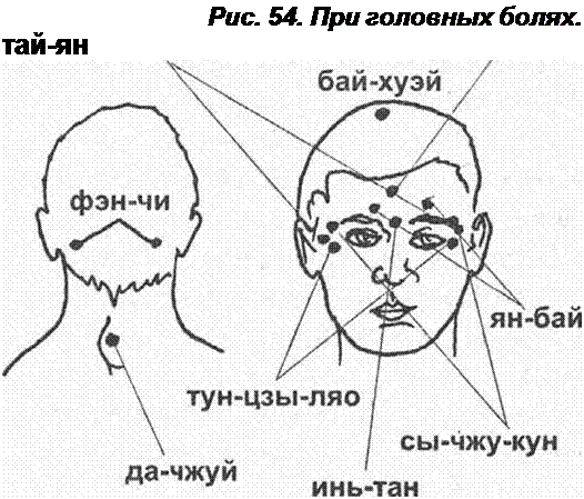 Головные точки массаж. Точечный массаж точек при мигрени. Акупрессура точечный массаж при головной боли. Акупунктурные точки при головной боли в лобной части. Точки массажа от головной боли.