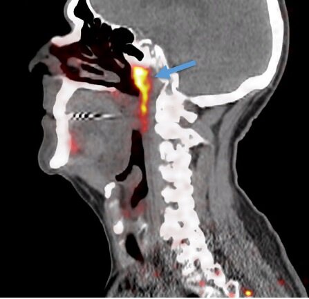 Предполагаемая  четвертая пара