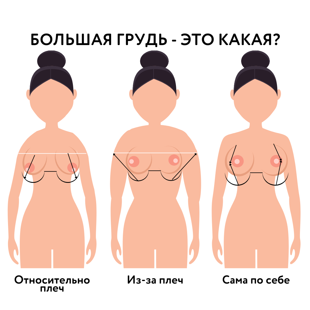 виды форм груди женщин фото 5