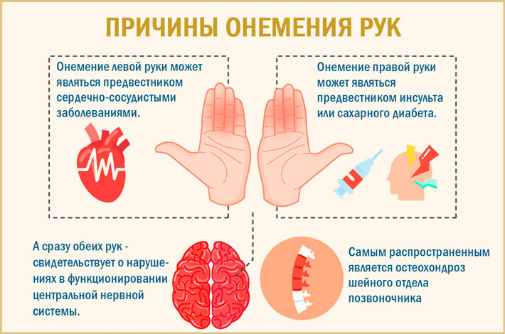 Если немеют пальцы на руках: причины, лечение и профилактика | Москва