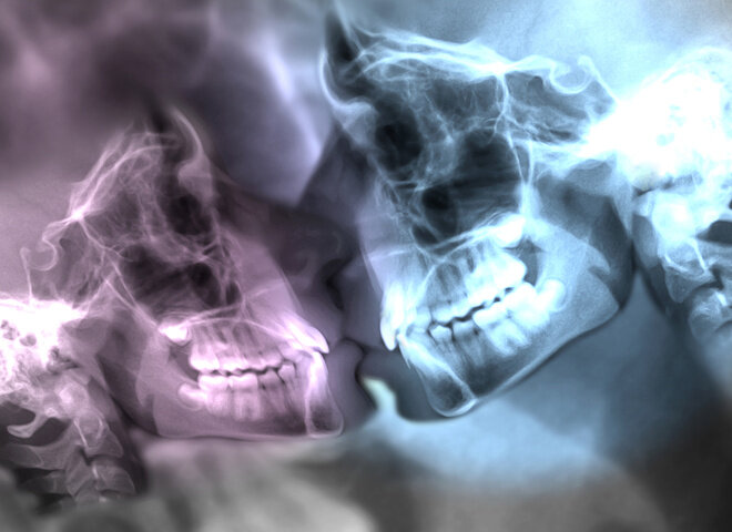 20 фактов о поцелуях, о которых ты не знала © depositphotos.com