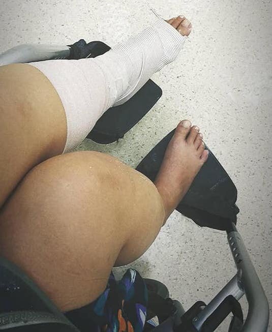 В этом же волшебном месте мне наложили гипс. Чудо чудеса!