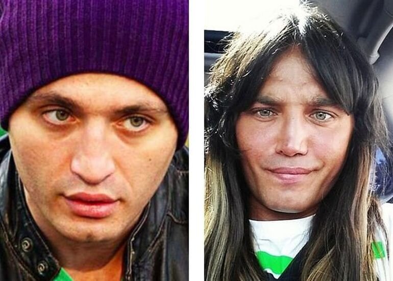 Рустам Солнцев до и после пластики. Фото как выглядит сейчас