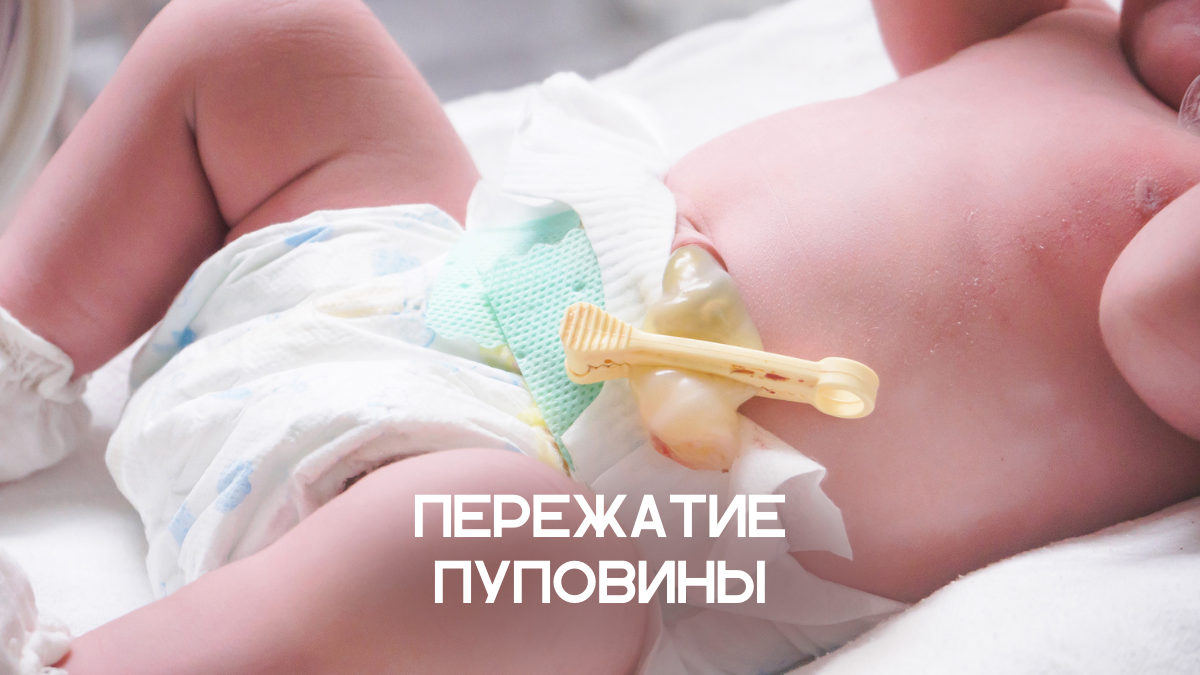 Пережатие пуповины в родах (фото Canva)