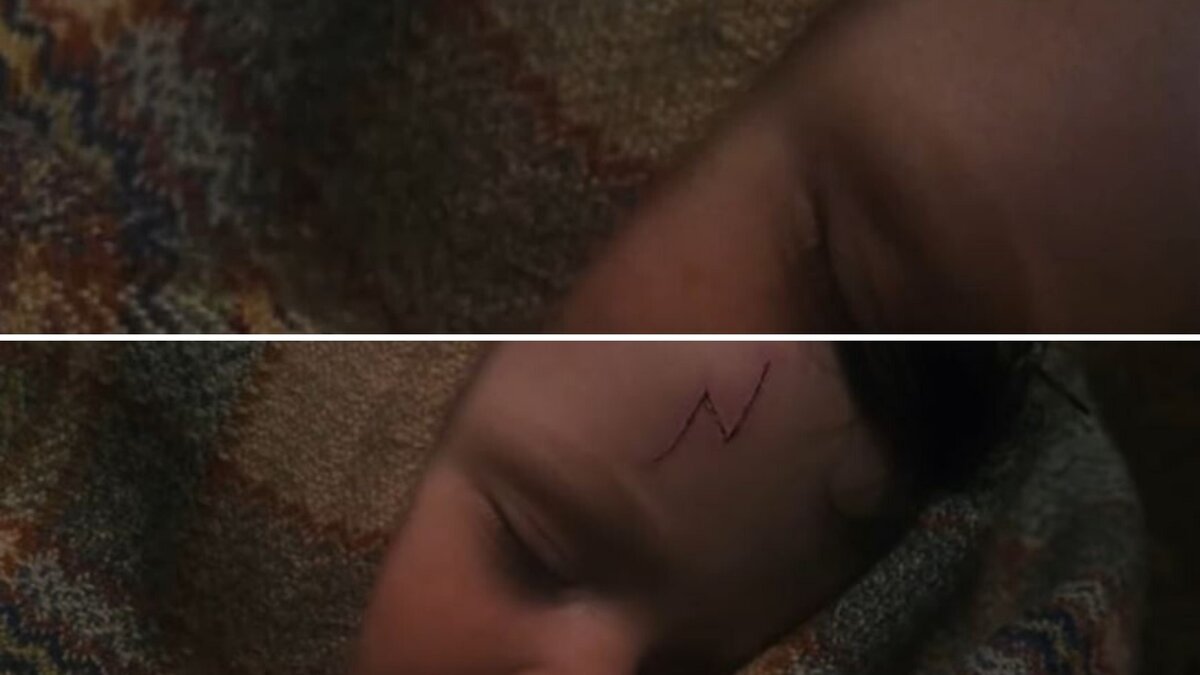 Гарри Поттер и Исчезающий шрам 