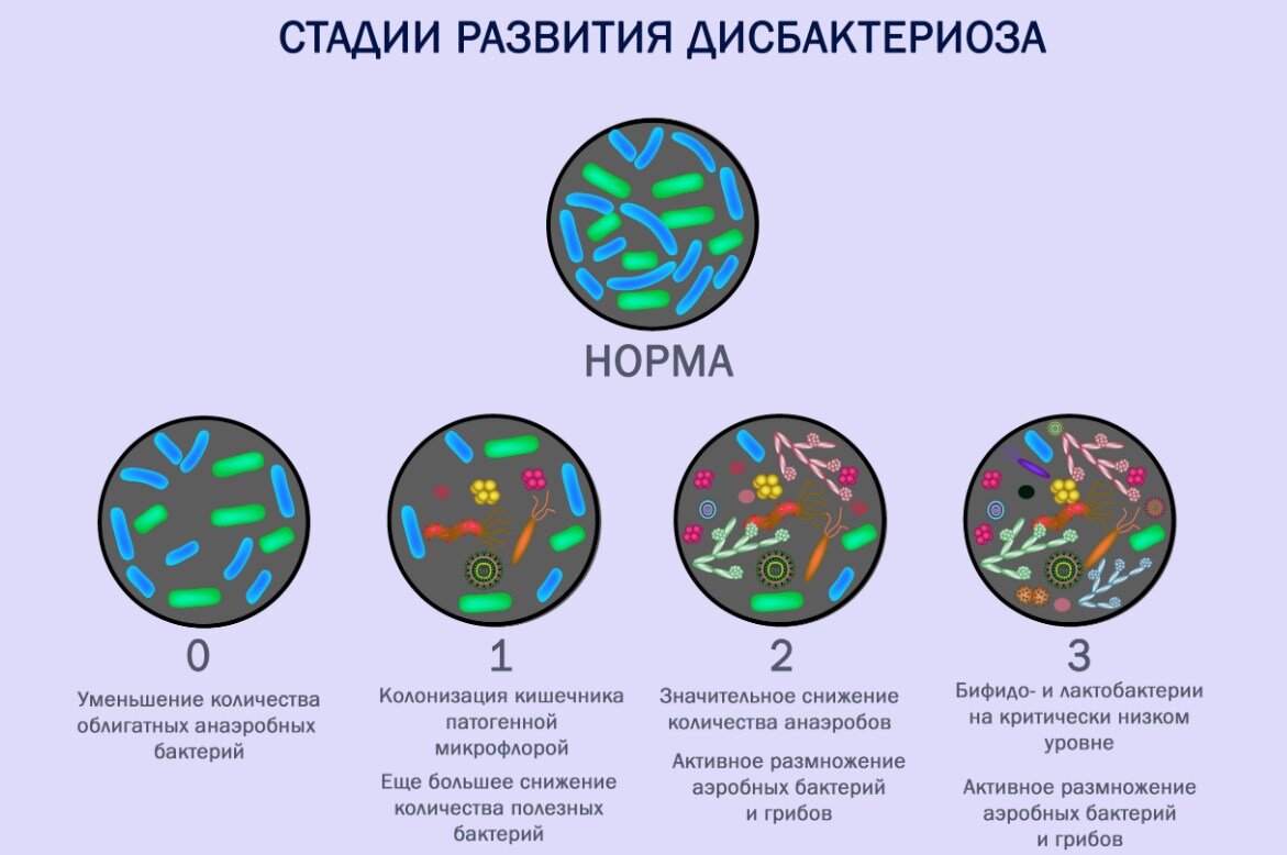 Как убрать патогенную флору в кишечнике схема