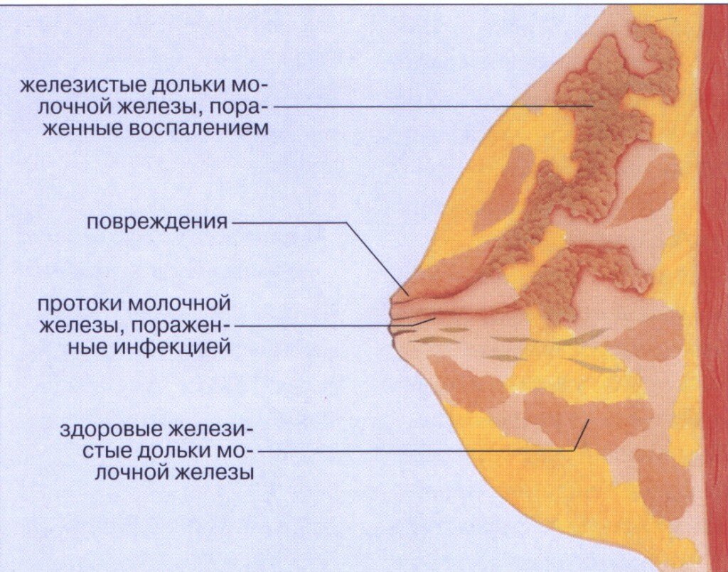 Что может случиться после родов? | Detki | Дзен