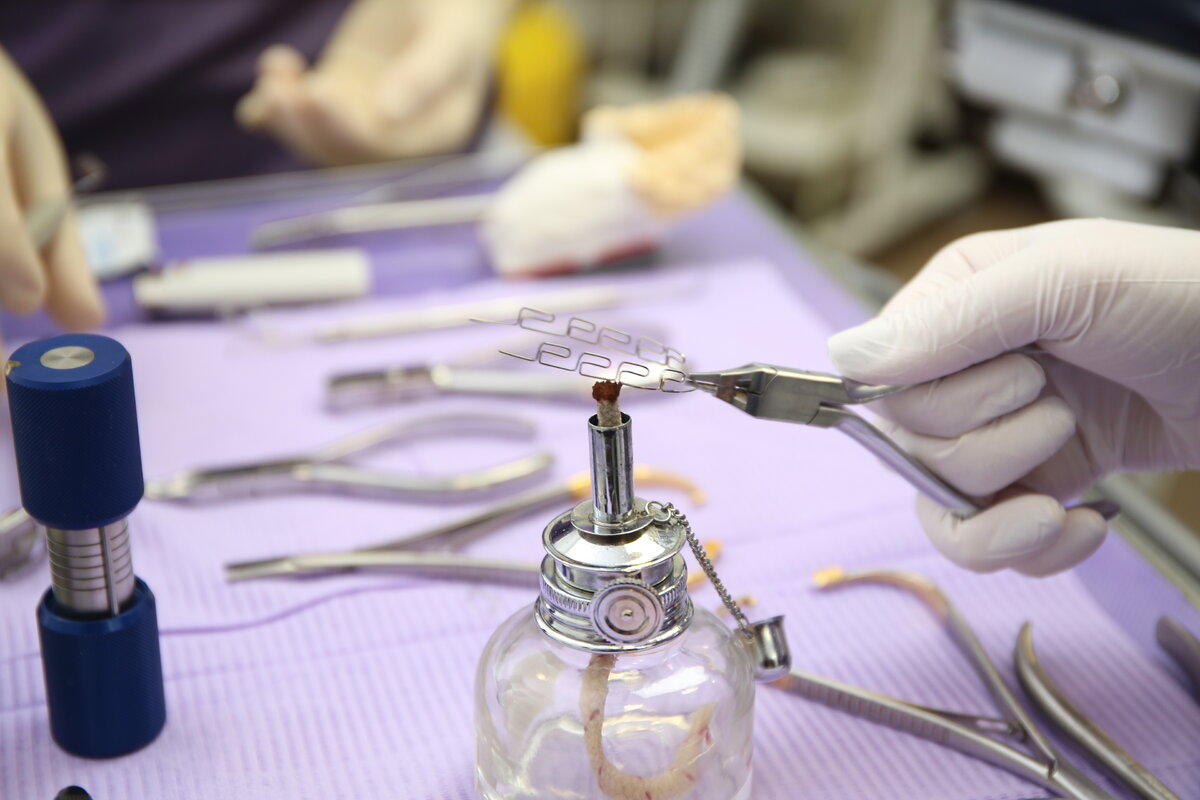 Техника Многопетлевой дуги в клинике Colibri Dental