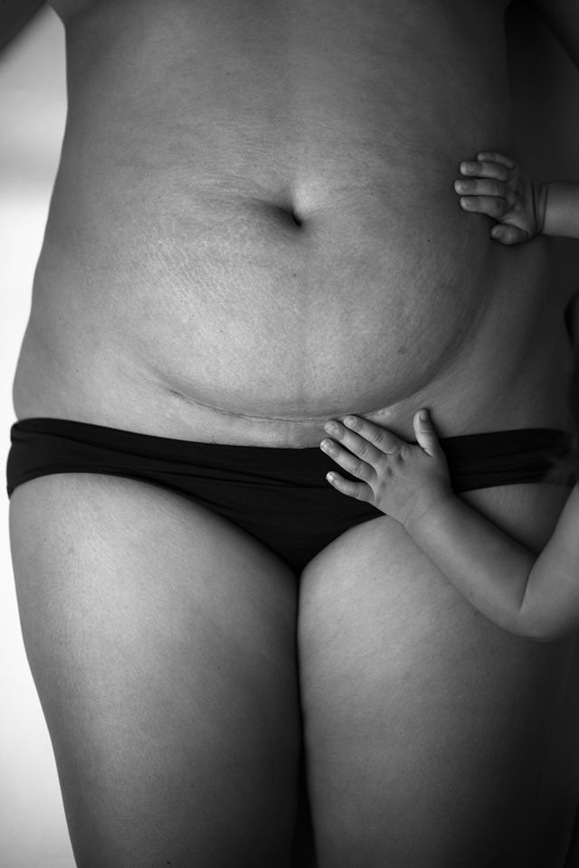 Обвисшая грудь после кормления: что делать? | Маммологический Центр