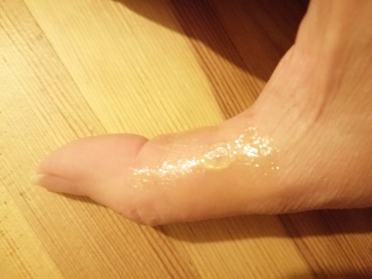 мозоль заклеенный БФ-6