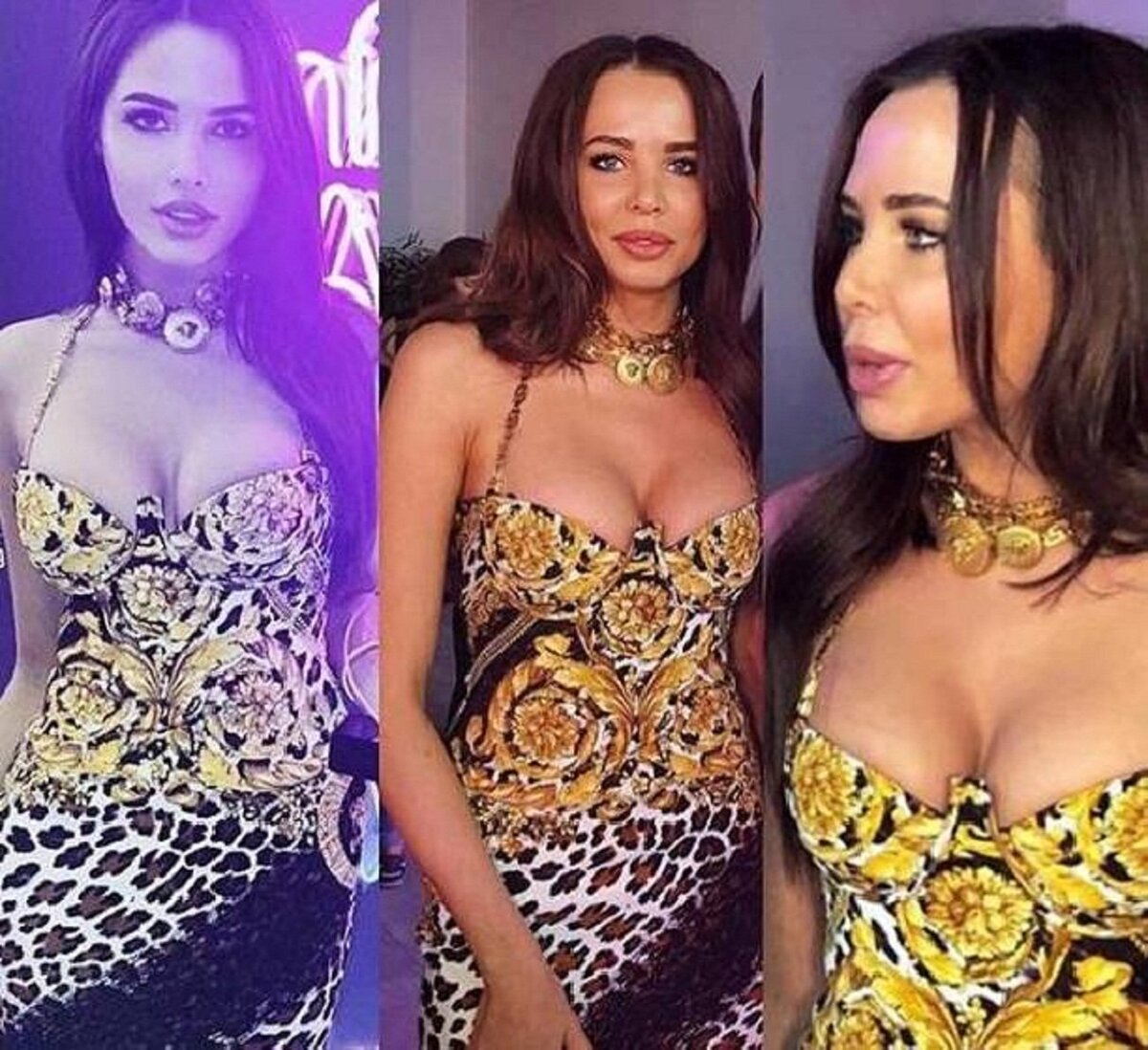 Анастасия решетова до и после пластики