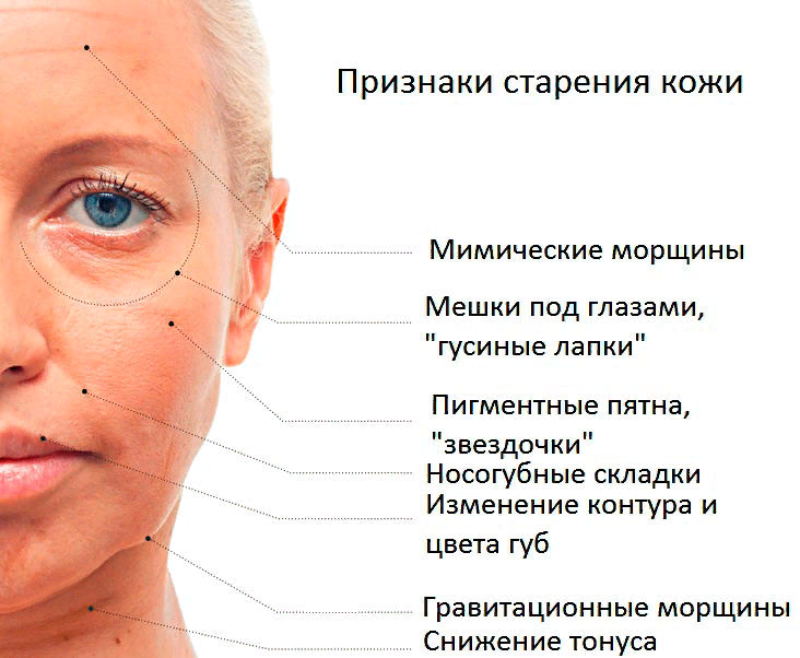 Возрастные изменения лица. Возрастные изменения кожи. Старение кожи. Признакистарения КОЖИЯ.