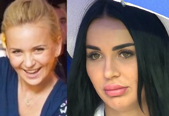 Дом 2 до и после пластики фото