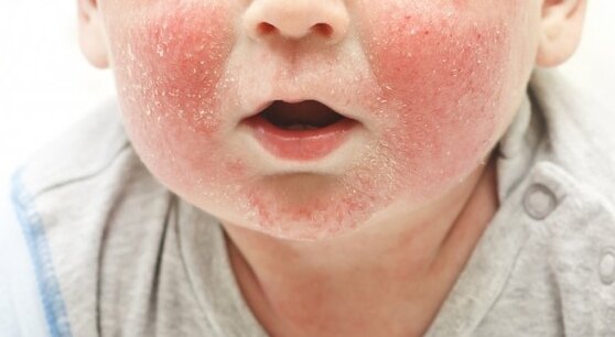 Фото взято на просторах интернета, для примера. 