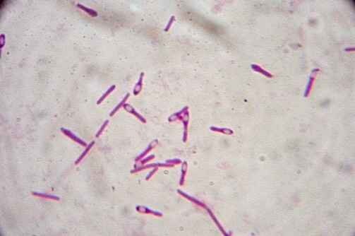 Clostridium botulinum собственной персоной. Бактерии похожи на булаву. Эти кружочки и есть споры