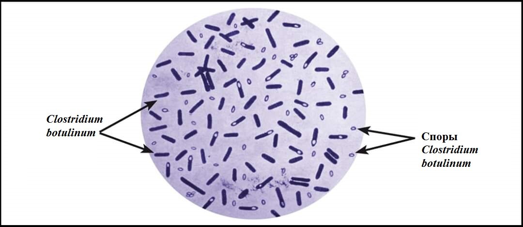 Бактерия, продуцирующая ботулотоксин, под микроскопом