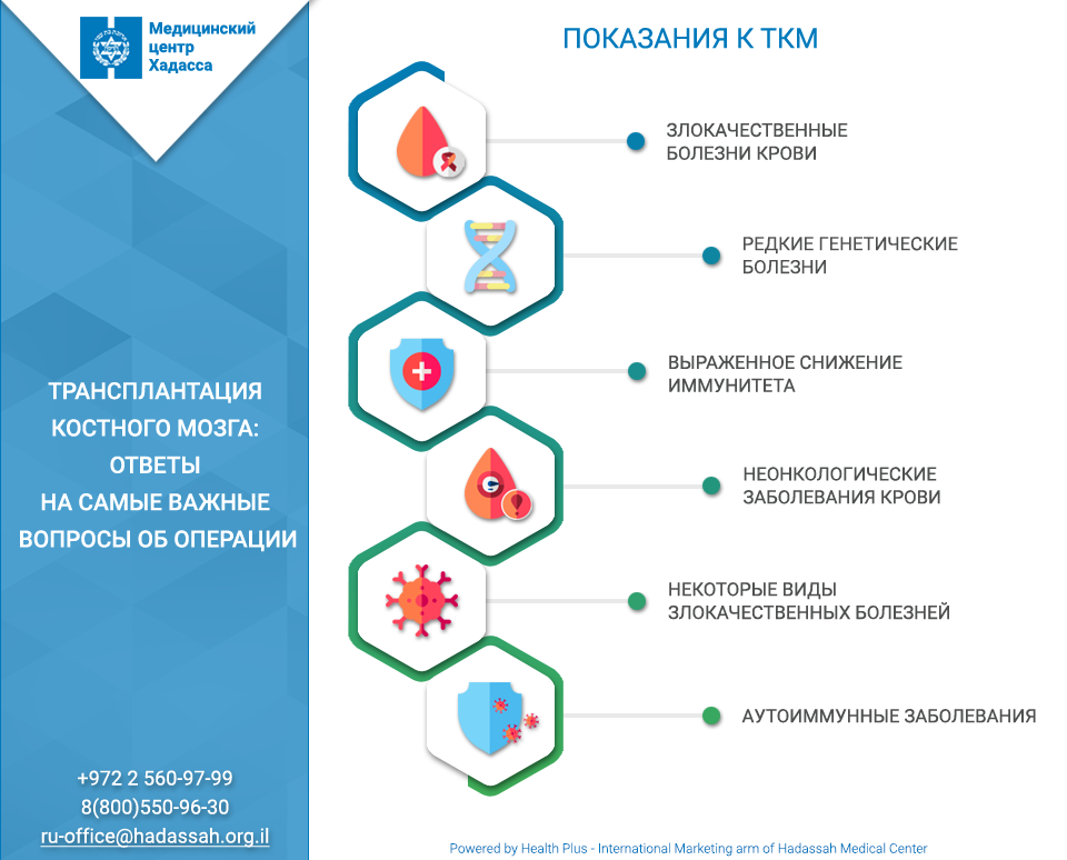 Сколько длится пересадка