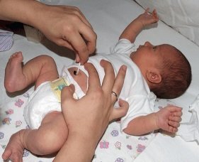 Культя пуповины, как правило отваливается на 5-15 день, после чего важно своевременно и правильно обработать пупочную ранку у малыша.