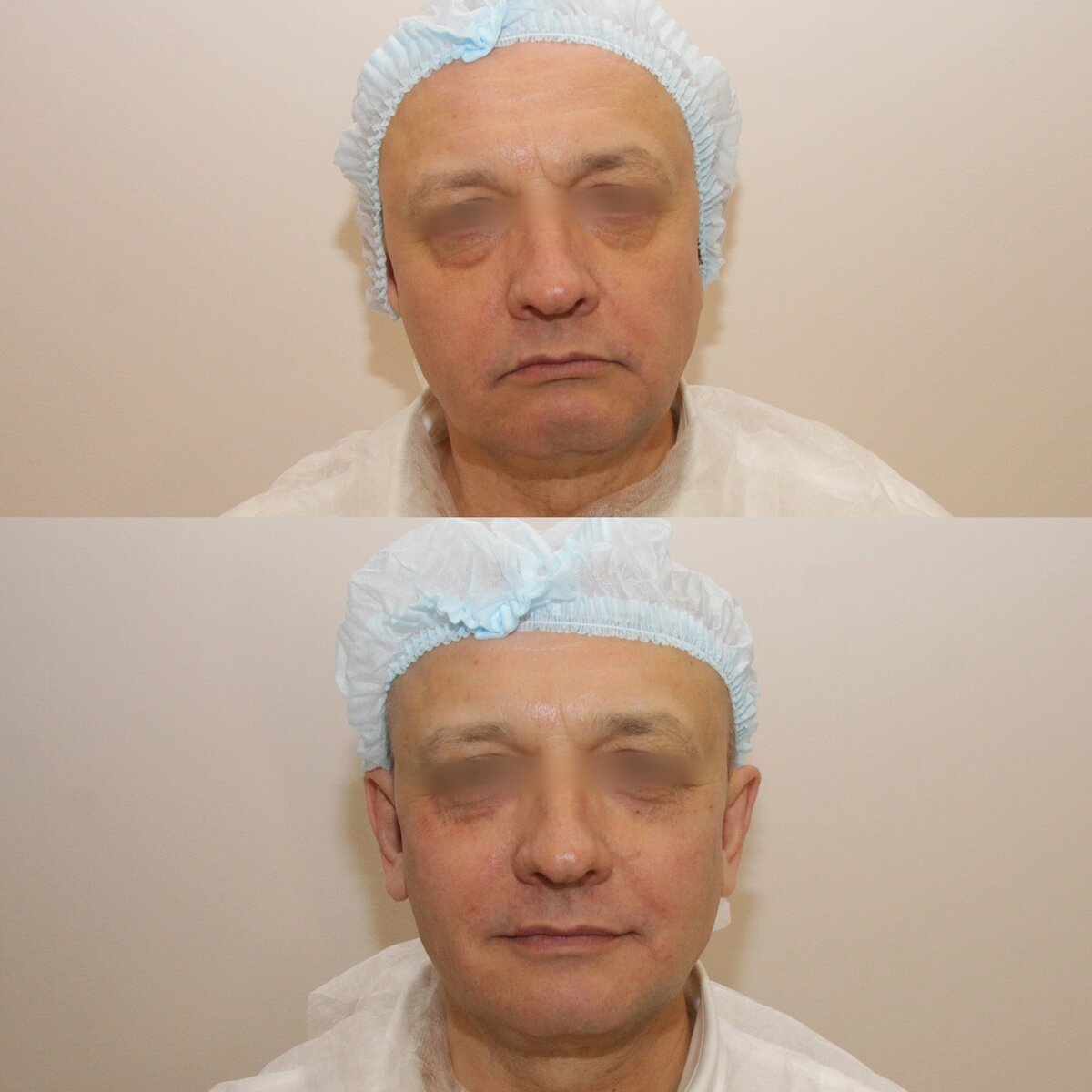 Методика Full Face