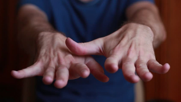 Тремор рук причины у взрослых - что делать если трясутся руки