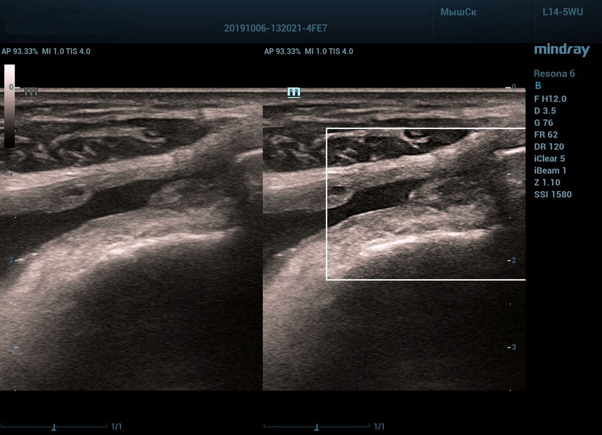 Прогрессивные технологии узи. Прогрессивные технологии узи. Скрининг исследование. Узи toshiba aplio 500. Прогрессивные технологии узи.