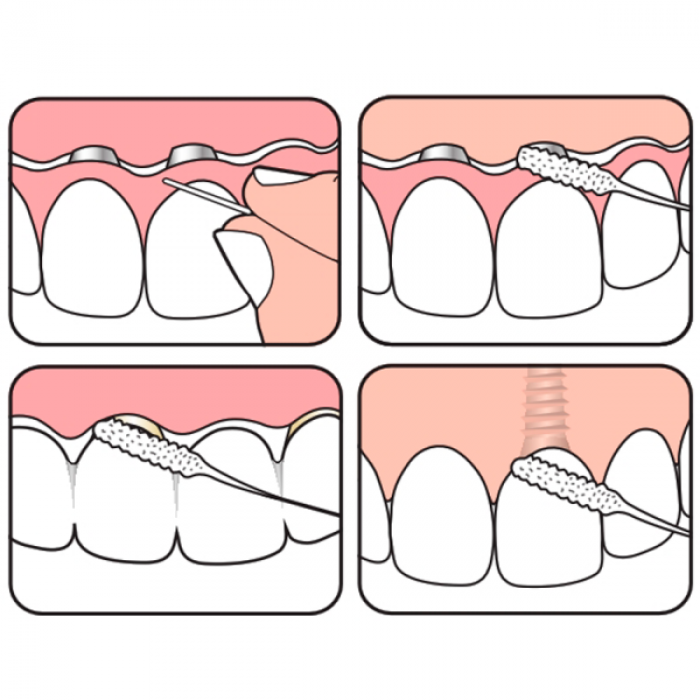 техника чистки суперфлосс