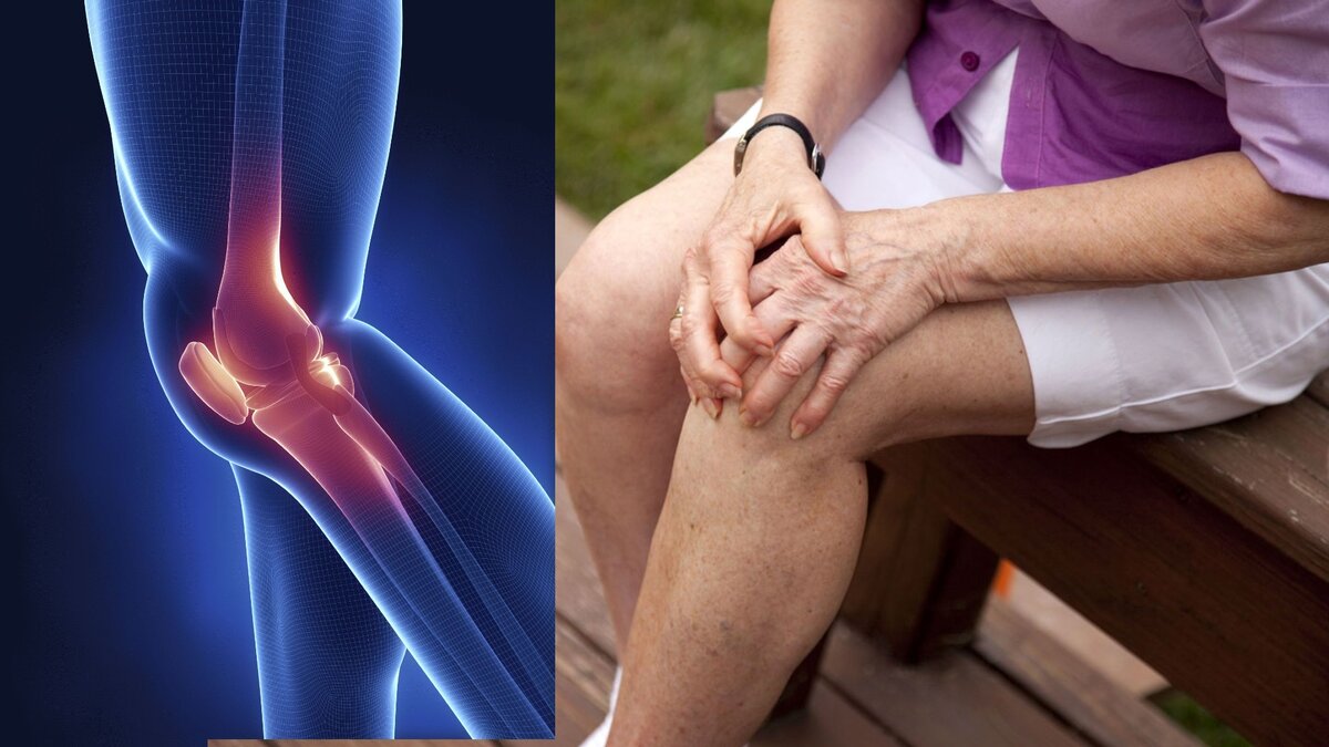 Источник фото: Яндекс. Картинки. Подписывайтесь а канал и ставьте лайк.