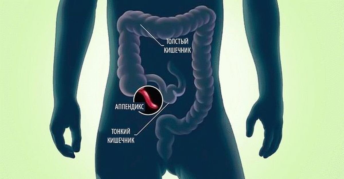 Расположение аппендикса в человеческом организме