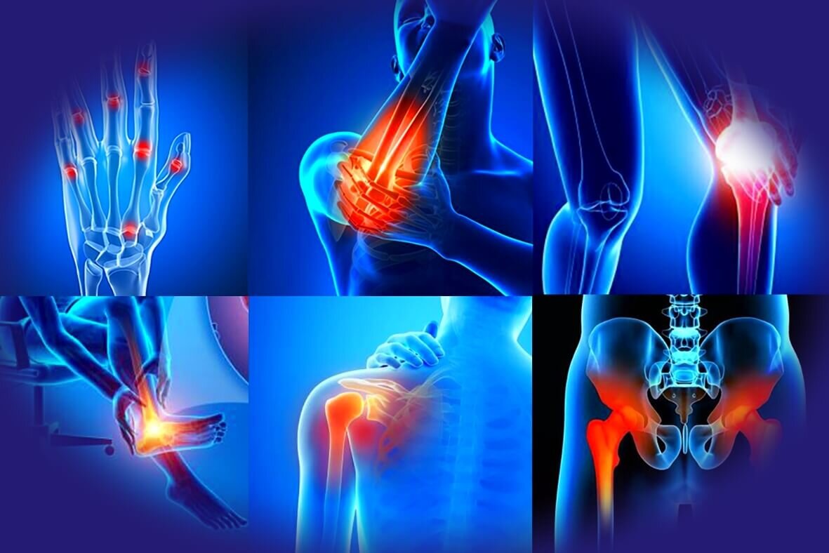 Суставы человека