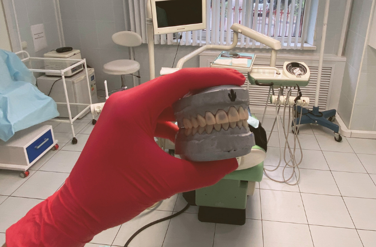 Wax-up восковая модель для изготовления протеза