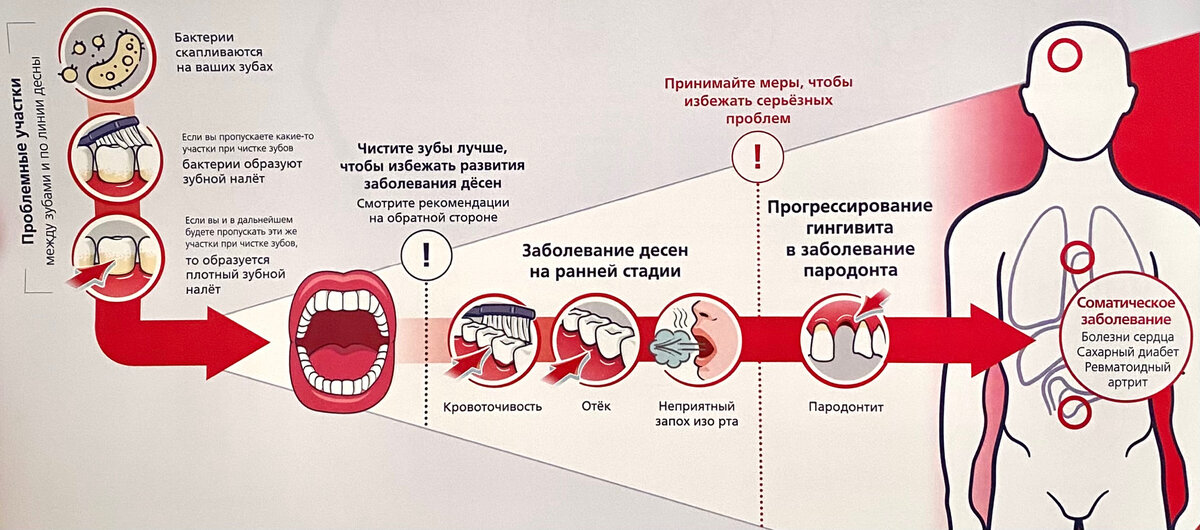 Факторы, способствующие распространению микроорганизма, вызывающего бетонную пыль