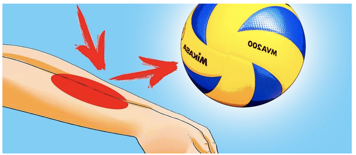 Нижним способом мяч передается не часто, однако этой технике стоит уделить должное внимание. Весомую долю очков удается заработать команде при умелом применении нижней передачи. 
Волейболисту приходится действовать моментально – он выставляет опорную ногу вперед, чтобы принять устойчивое положение, а вторую ногу опускает вниз (на колено). При таком раскладе важно держать спину вертикально, а после непосредственного соприкасания мяча со сцепленными руками можно слегка наклониться вперед для перенаправления кинетической энергии и формирования траектории движения мяча.