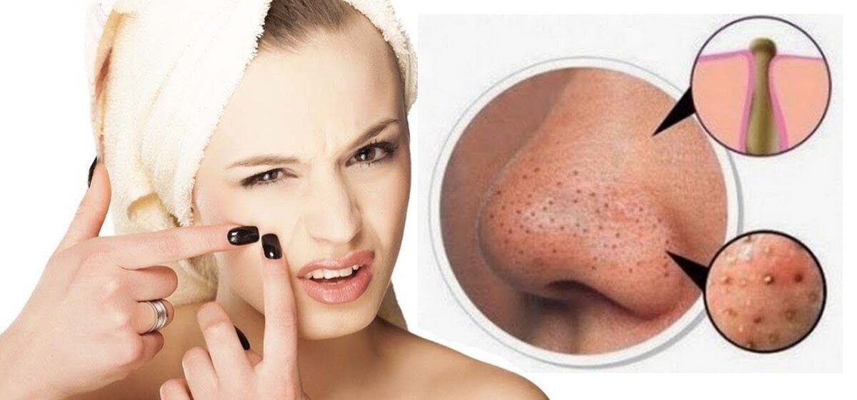 Фото взято из открытых источников.