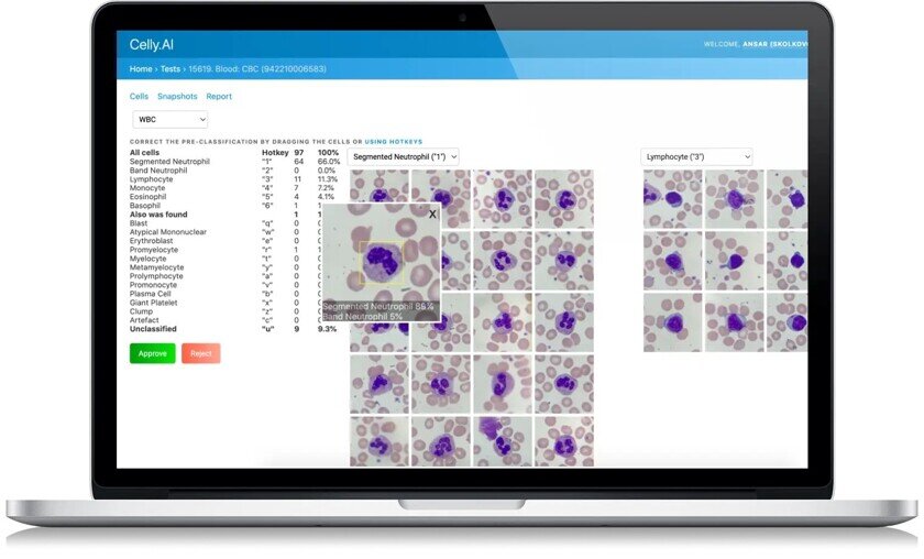    Приложение, распознающее результаты в микроскопе / Источник: Celly.ai