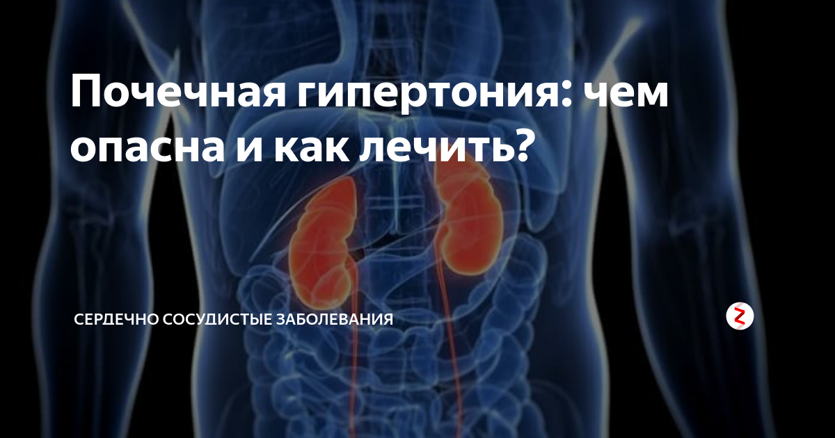 Почечная гипертония: чем опасна и как лечить? | СЕРДЕЧНО СОСУДИСТЫЕ ...