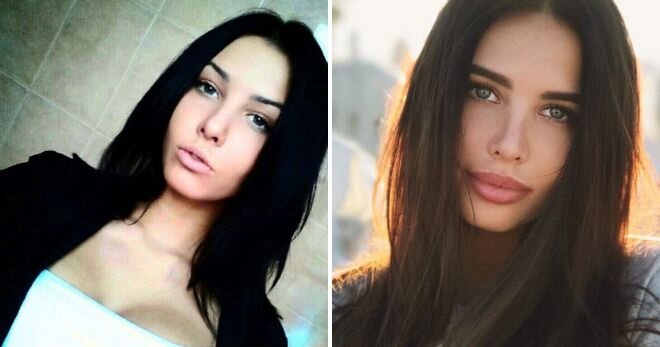 Алина андриевская до пластики фото Чудеса пластики: 15 звезд российского Instagram до и после ИНТЕРЕСНЫЕ ФАКТЫ Дзен