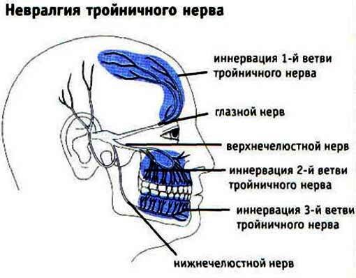 Воспаление тройничного нерва к стоматологу или неврологу?