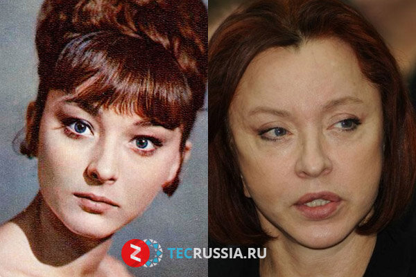 Фото вертинской анастасии до и после пластики