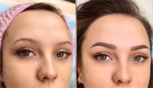 Тонкая бровь делает веко шире, а взгляд выразительнее. А когда у девушки широкая бровь, то возникает некая тяжесть, она выглядит взрослее, глаза уменьшаются. Хотя сама коррекция здесь удачнее, чем в первом примере. 