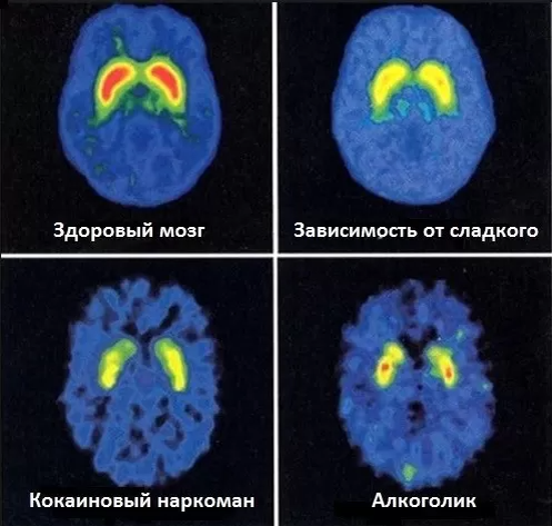 Источник:https://www.lotos74.ru/about/blog/vred-sladkogo-dlya-organizma-pochemu-ot-sakhara-tolsteyut/