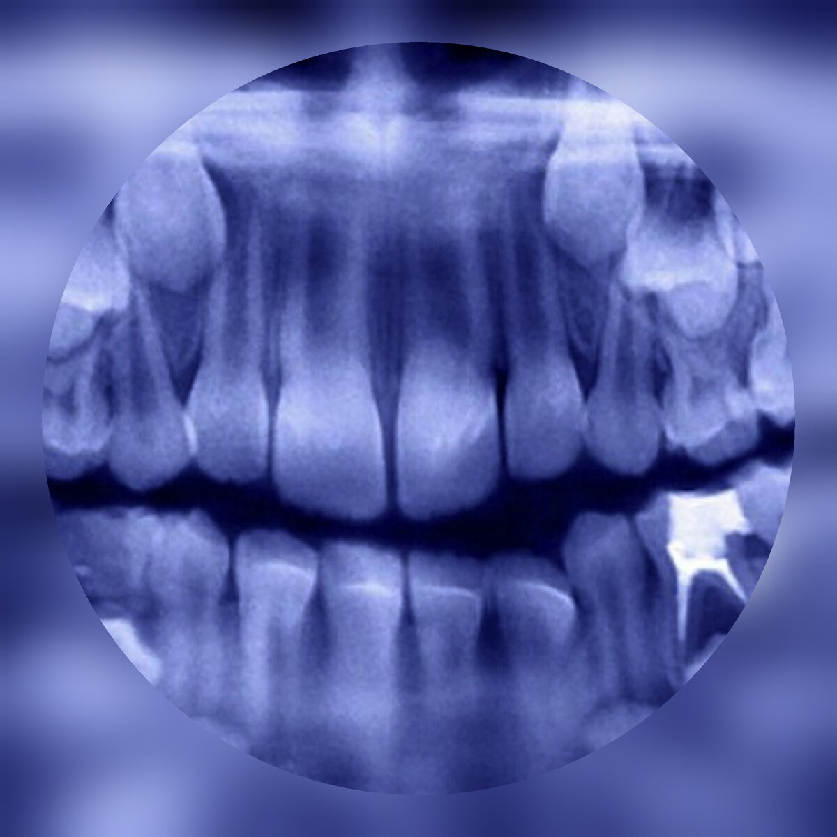 Снимок зубов