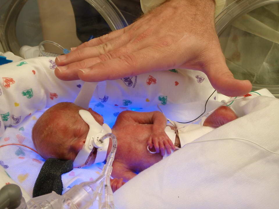 Фото с сайта https://двойня.com/беременность-двойней-по-неделям/24-неделя-беременности-двойней/