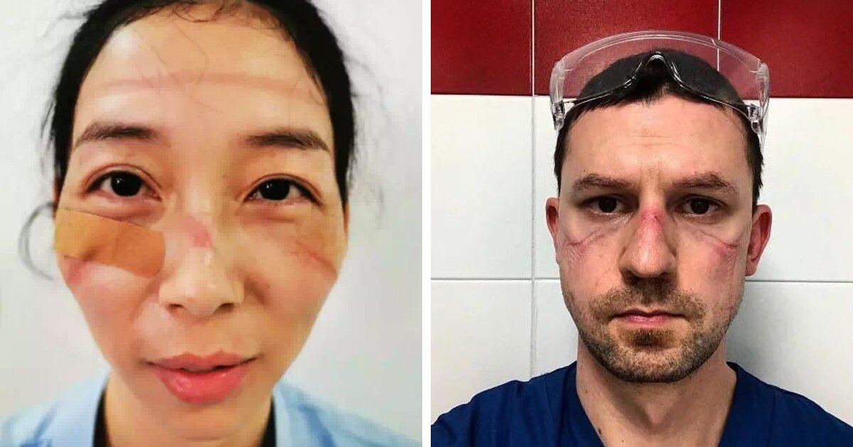 яндекс фото. Врачи после смен.