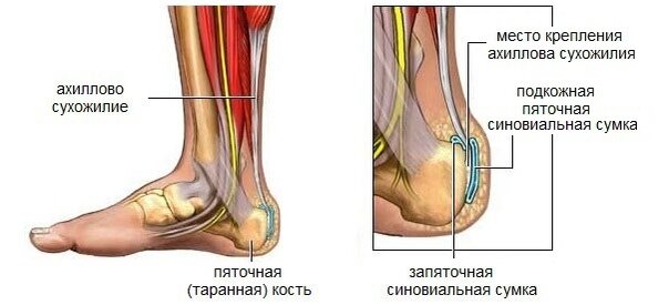 Перонеальный тендинит и тендовагинит