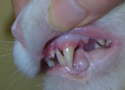 Воспаление десны около зуба лечение в домашних условиях