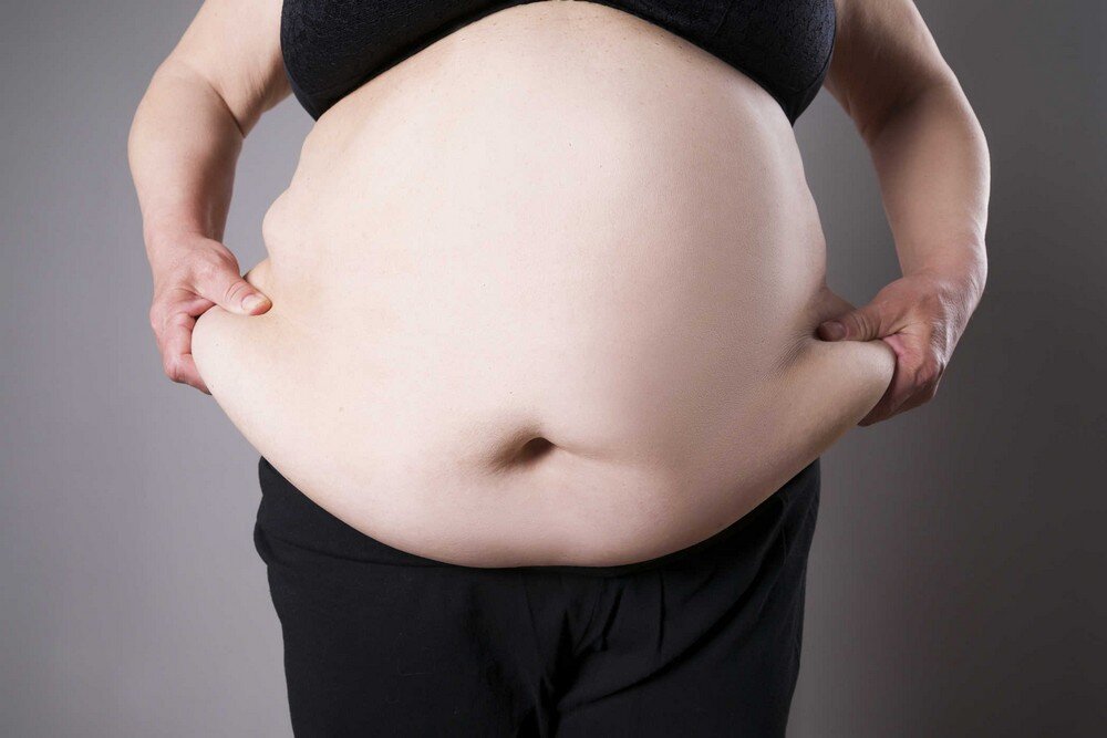 Эндокринолог рассказала, откуда берется и чем опасен жир на животе - Российская газета