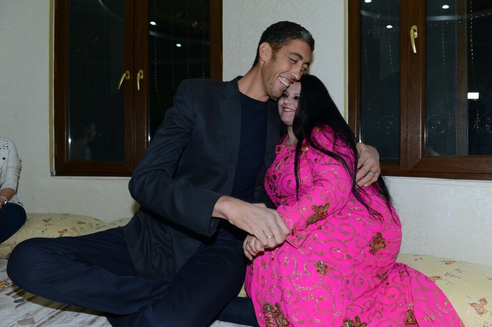 Самый высокий человек в мире — 2,51-метровый Султан Косен, слева, позирует со своей невестой Мерве Дибо во время «ночи хны», накануне свадьбы. Провинция Мардин, Турция, 26 октября 2013 года  из-за патологии, чаще встречающейся у мальчиков, больные не могут вести нормальную жизнь, поскольку у них наблюдается расстройство физического и психического состояния: они жалуются на головные боли, ухудшение памяти и зрения, боль в суставах, а также половую слабость.Однако, несмотря на все эти симптомы, Султан был полон решимости вести жизнь обычного человека: ходить на работу и возвращаться домой к супруге. Турку удалось реализовать часть задуманного — он устроился на неполный рабочий день на ферму, чтобы не быть обузой для своих родственников