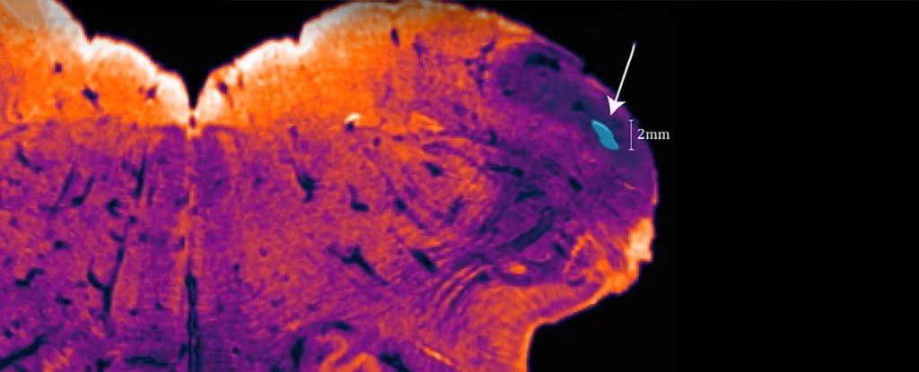 Ядро веревчатого тела