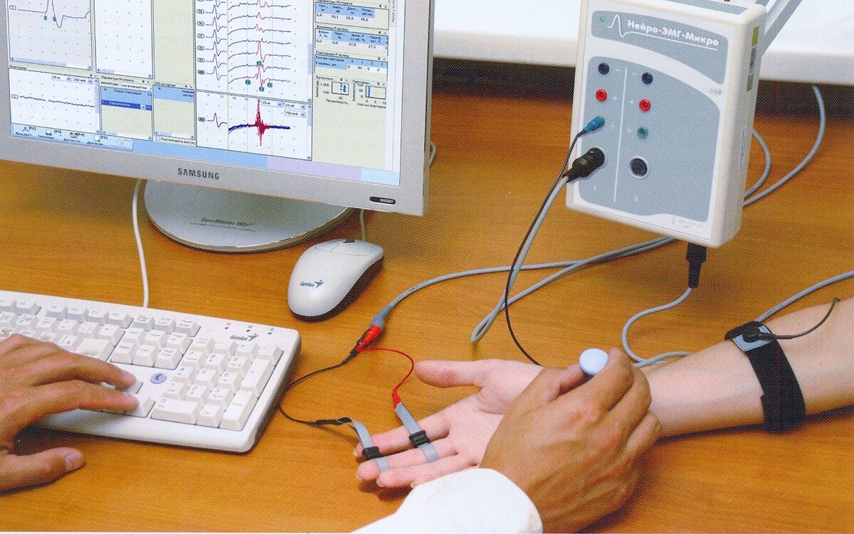 M testing. Декремент ЭМГ. Декремент тест ЭНМГ. Электромиография (EMG).